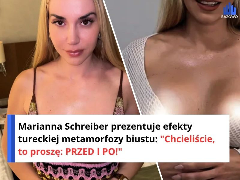 Marianna Schreiber prezentuje efekty tureckiej metamorfozy biustu: "Chcieliście, to proszę: PRZED I PO!"